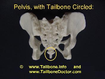Tailbone Coccyx Tailbone Pain 