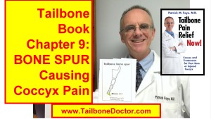 Chapter 9 of Tailbone Pain Book: Coccyx BONE SPUR, Tailbone  Spicule