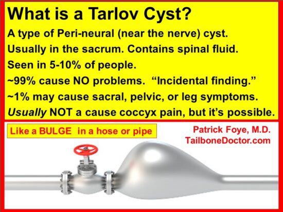 Tarlov Cyst info, Coccyx Pain, Tailbone Pain, Coccydynia, Patrick Foye MD