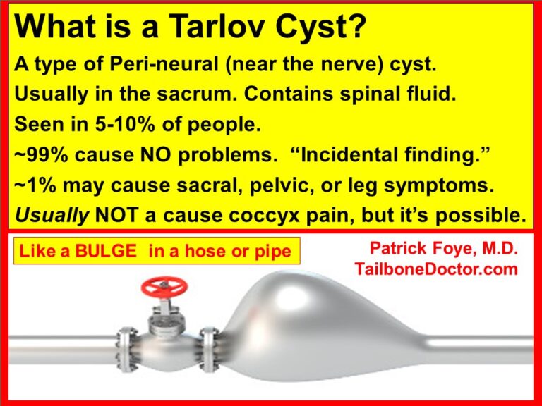 How to Tell Tarlov Cyst Pain from Tailbone Pain (Coccyx Pain