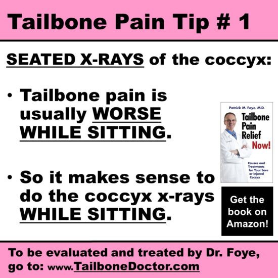 Tailbone Pain Tip 1, Seated x-rays for Coccyx Pain, Coccydynia