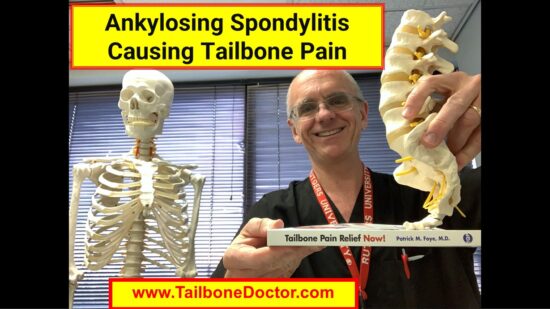 Ankylosing Spondylitis Causing Coccyx Pain, Tailbone Pain, Coccydynia. Patrick Foye MD