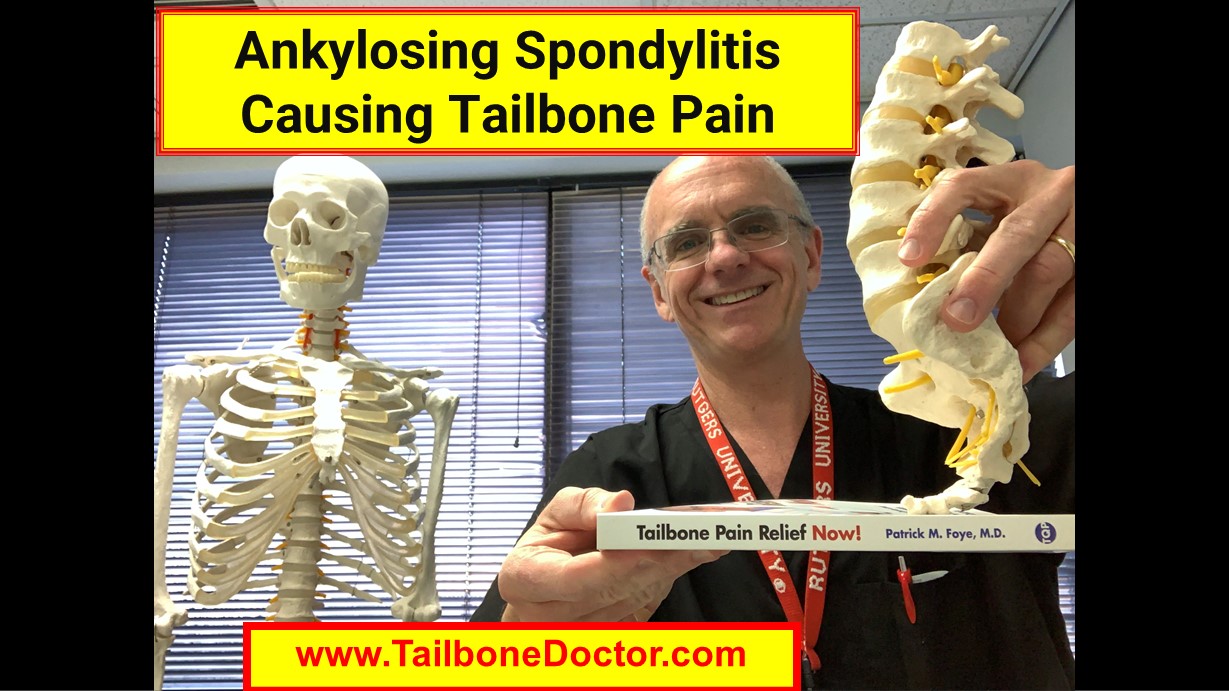 https://tailbonedoctor.com/wp-content/uploads/2022/04/Ankylosing-Spondylitis-Causing-Coccyx-Pain-Tailbone-Pain-Coccydynia.-Patrick-Foye-MD.jpg