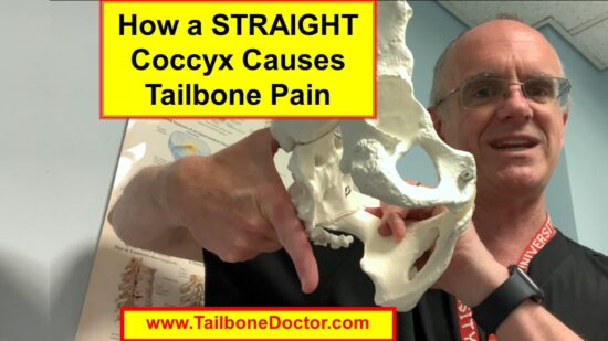 STRAIGHT Coccyx Causes Tailbone Pain, Coccyx Pain, coccydynia, Patrick Foye MD